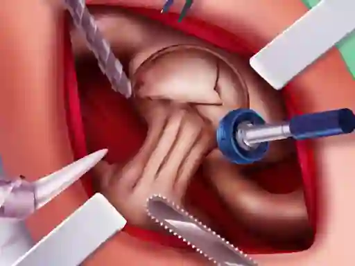 Peli Princess Hips Surgery verkossa